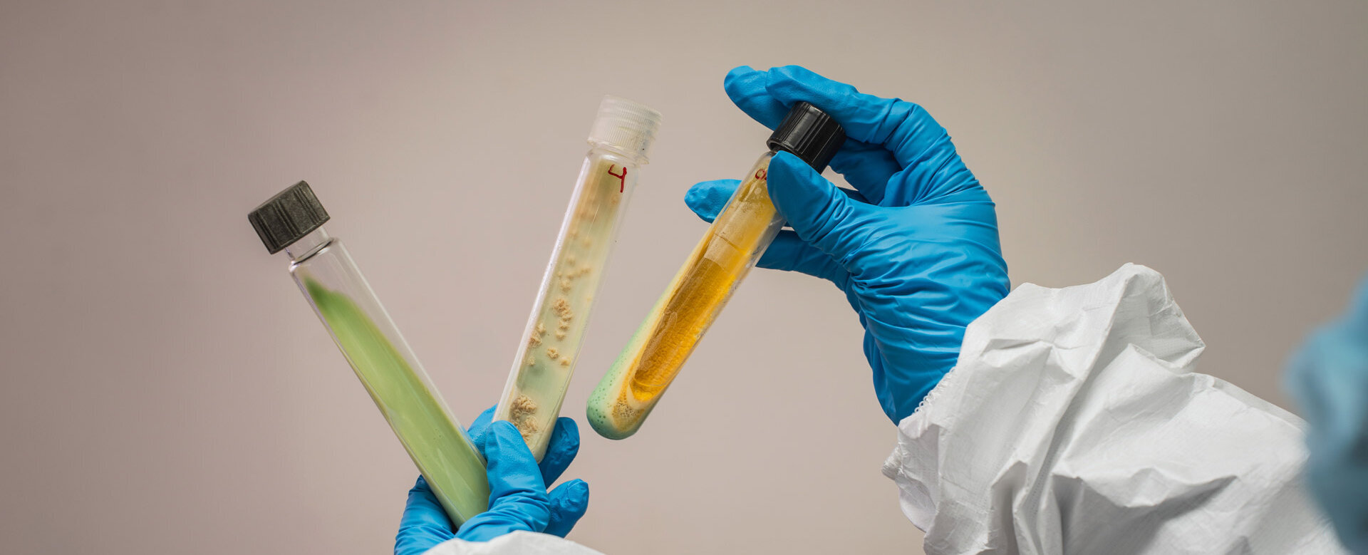 Según el tipo de micobacteria se emplean distintos medios de cultivo para evaluar su comportamiento y morfología. Foto: María Fernanda Londoño, Unimedios. 