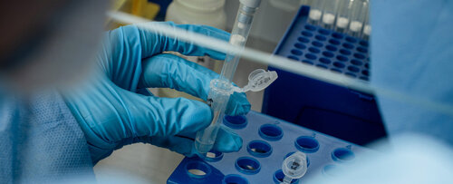 Las pruebas de genética realizadas en la UNAL siguen protocolos reconocidos internacionalmente. Foto: María Fernanda Londoño, Unimedios.