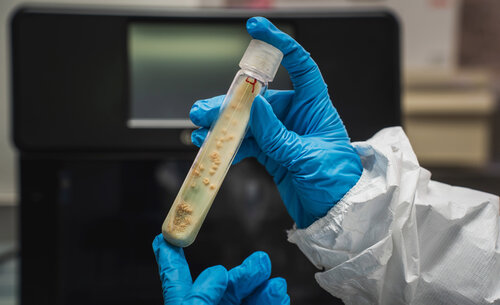 El laboratorio de micobacterias no solo se dedica a la investigación básica, sino también al diagnóstico especializado. Foto: María Fernanda Londoño, Unimedios